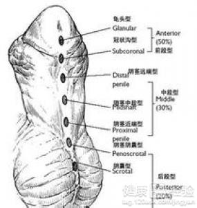 第2步