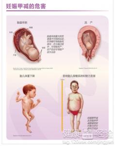 母親患甲減會不會影響正在哺乳的嬰兒