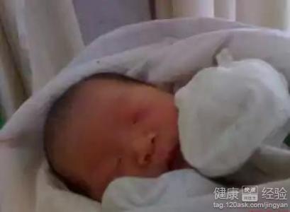 新生嬰兒“全關節攣縮症”，怎麼辦