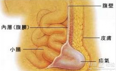 小兒疝氣手術後九天了開刀處有些腫脹正常嗎